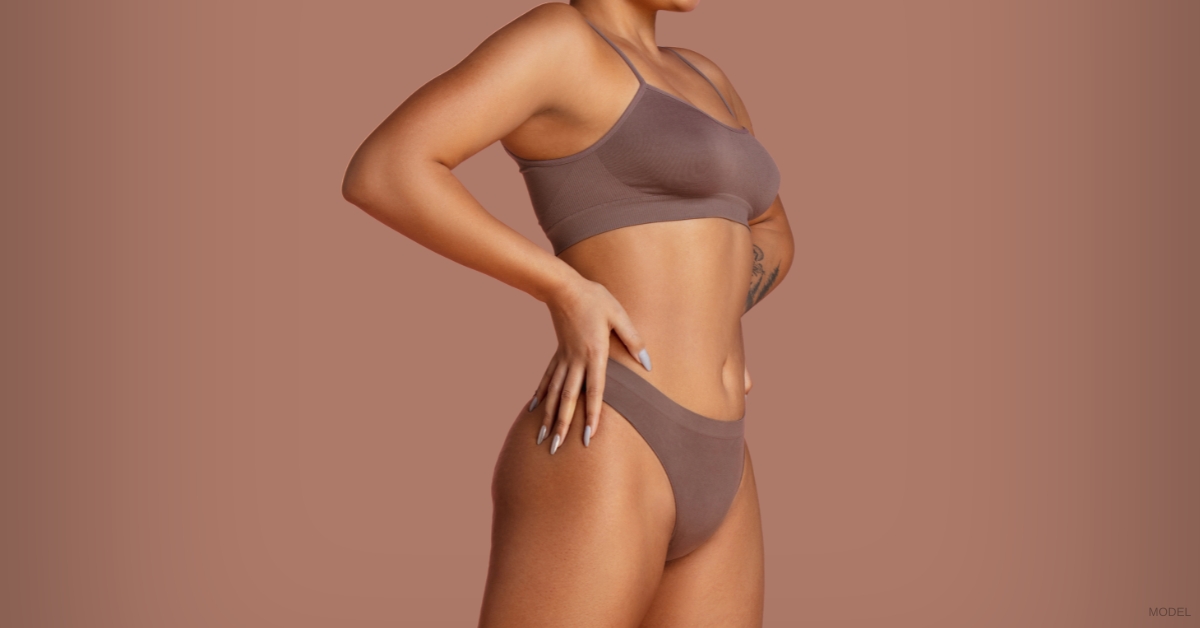 Close-up of a woman after full tummy tuck recovery showing final results (Model)
