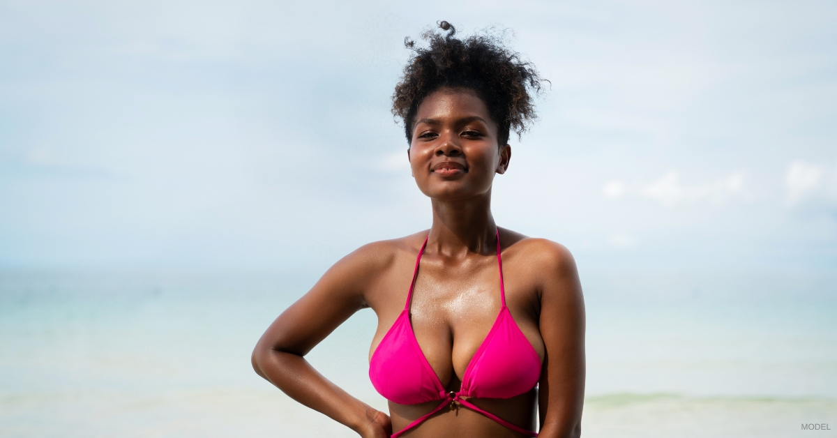 Woman showcasing breast reduction surgery results (Model)